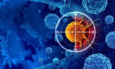 Thử nghiệm thuốc tiêm điều trị ung thư xóa sổ khối u chỉ sau vài tuần