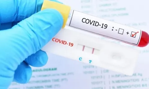 Bộ Y tế ban hành giá xét nghiệm COVID-19 mới: Giảm 30% so với trước