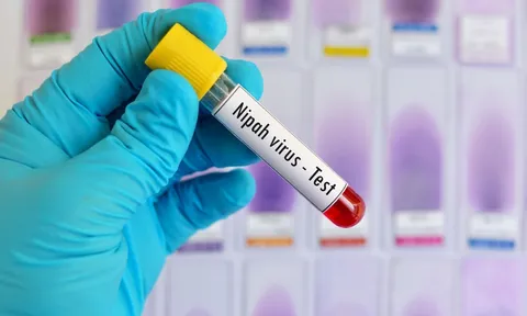 Bộ Y tế khuyến nghị người dân nâng cao cảnh giác với virus Nipah