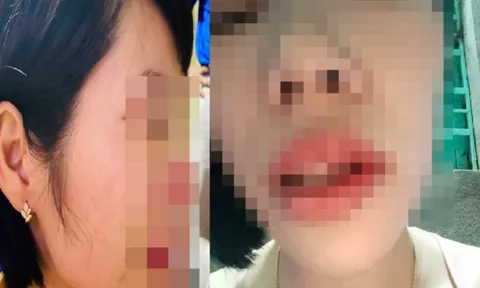 Đắk Nông chỉ đạo xử lý việc cô giáo bị hành hung