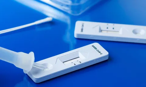 Cách phân biệt 'dương tính giả' khi tự làm test nhanh COVID-19 tại nhà