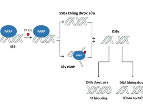 Liệu pháp ức chế PARP trong điều trị ung thư