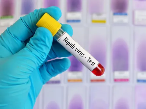 Bộ Y tế khuyến nghị người dân nâng cao cảnh giác với virus Nipah